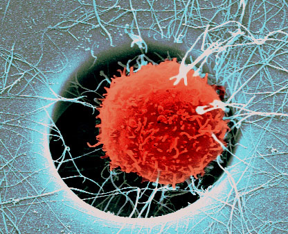 Hematopoietic stem cell