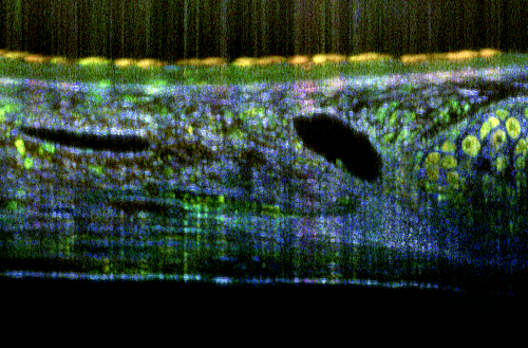 Eine OCT-Schnittbilddarstellung von einer Trachea der Maus. Der Farbkontrast entsteht durch dynamische Bewegungen von Strukturen unterhalb der Auflösungsgrenze.